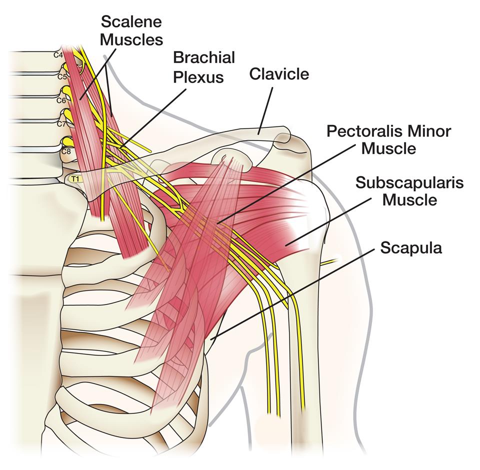brachial plexus injuries