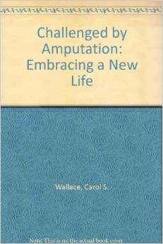 Challened by Amputation: Embracing a New Life